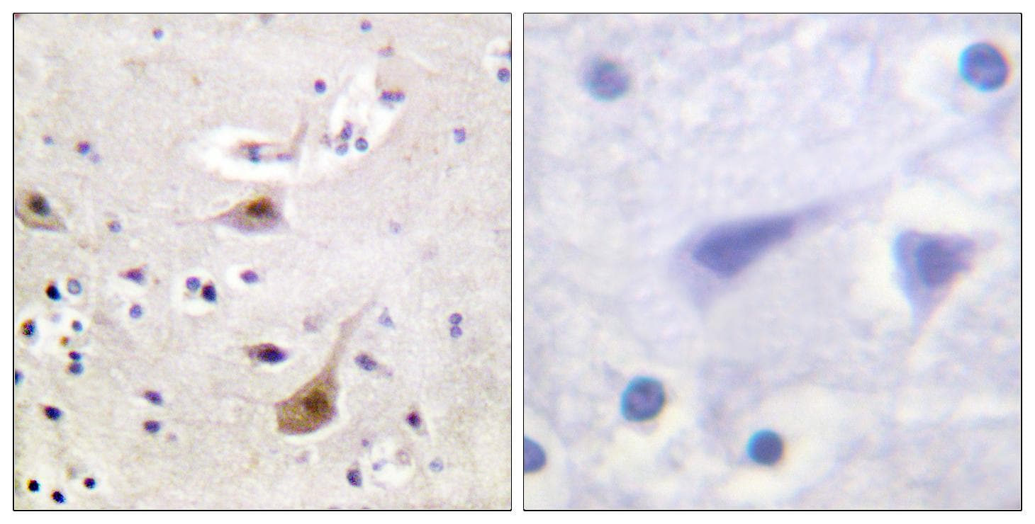 Polyclonal Rabbit anti-Human AR / Androgen Receptor Antibody (Ab-94, IHC, IF)