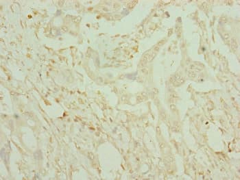 CDO1 / Cysteine Dioxygenase Antibody