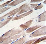 DES / Desmin Antibody (Thr16)