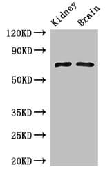 GAA / Alpha-Glucosidase, Acid Antibody (aa601-952)