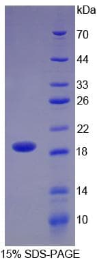 Rat NRG1 / Heregulin / Neuregulin Protein (Recombinant His)