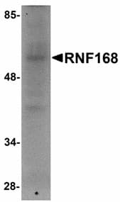 Polyclonal Rabbit anti-Human RNF168 Antibody (WB)