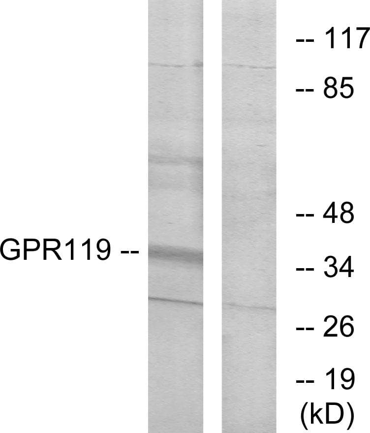 GPR119 Antibody