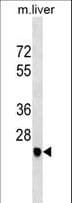 SGCD / Delta-Sarcoglycan Antibody (aa232-261)
