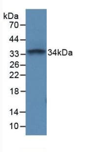 CD45 / LCA Antibody (aa371-556, PE)