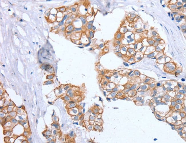 PTP4A2 / PRL-2 Antibody