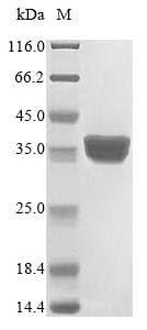 Fruit fly RPS3 / Ribosomal Protein S3 (Recombinant 6His, N-terminus)