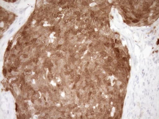 p16INK4a / CDKN2A Antibody (clone OTI3G3)
