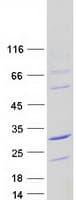 Human HCFC1R1 / HPIP Protein (Recombinant Myc-DDK (Flag))