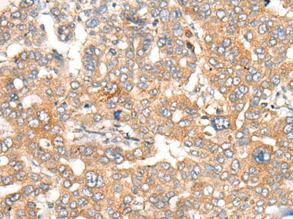 CASP4 / Caspase 4 Antibody