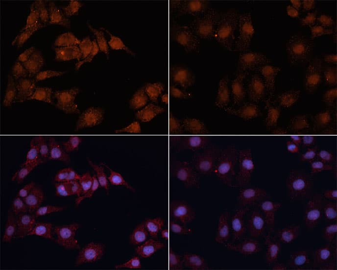 MAP1LC3B / LC3B Antibody