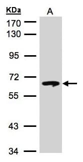 GBA / Glucosidase Beta Acid Antibody (aa352-536)