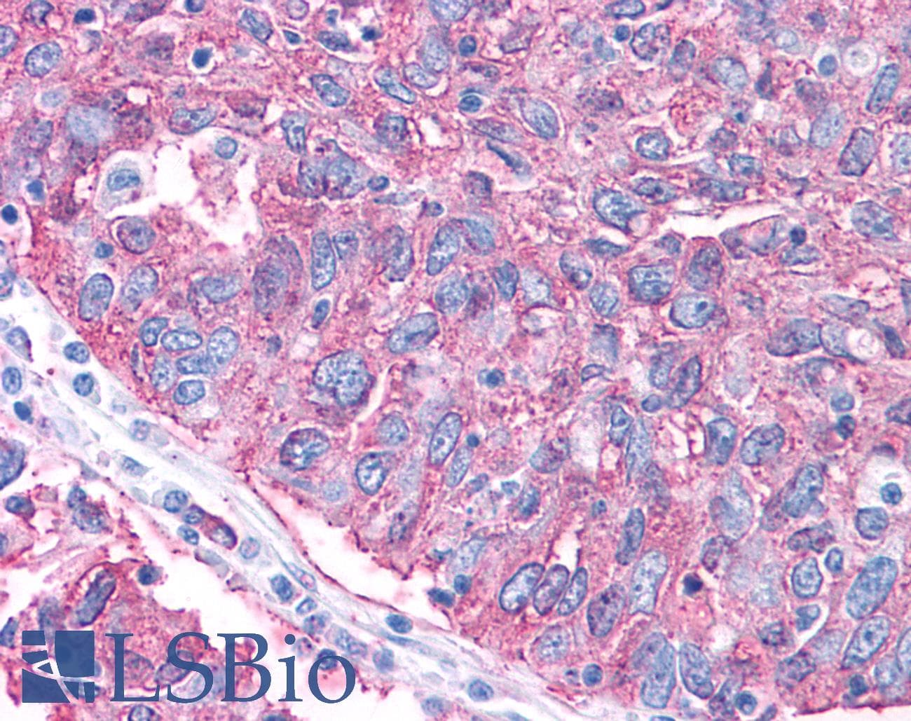 PathPlus™ GRM2 / MGLUR2 Antibody (N-Terminus)