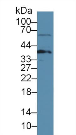 LAT Antibody (aa30-237)