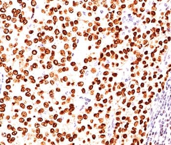 PR / Progesterone Receptor Antibody (clone PR484, Ready-to-Use)