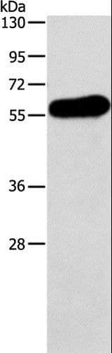 Polyclonal Rabbit anti-Human APOH / Apolipoprotein H Antibody (aa21-226, IHC, WB)