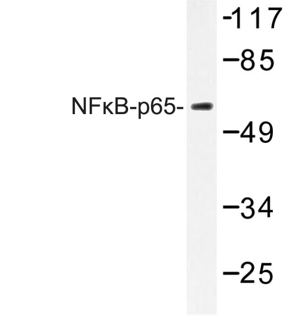 RELA / NFKB p65 Antibody (Lys303)