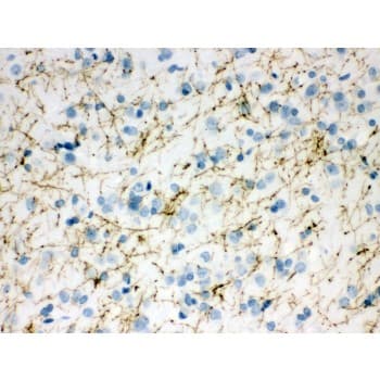 TH / Tyrosine Hydroxylase Antibody (aa193-222)