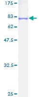Human CDCA1 / NUF2 Protein (Recombinant GST)