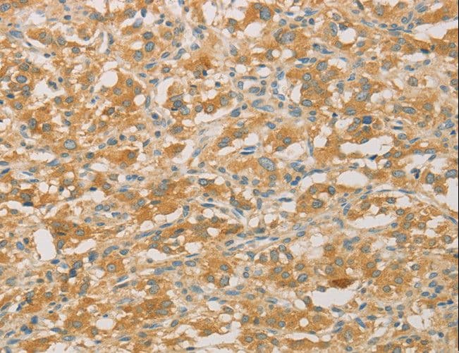 Polyclonal Rabbit anti-Human PRPSAP1 Antibody (IHC)