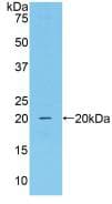 CAT / Catalase Antibody (aa80-239, APC)