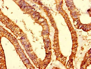 Polyclonal Rabbit anti-Human MRPS10 Antibody