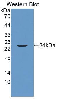 TMEM16B / ANO2 Antibody