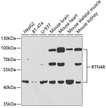 Polyclonal Rabbit anti-Human RTN4R Antibody (WB)