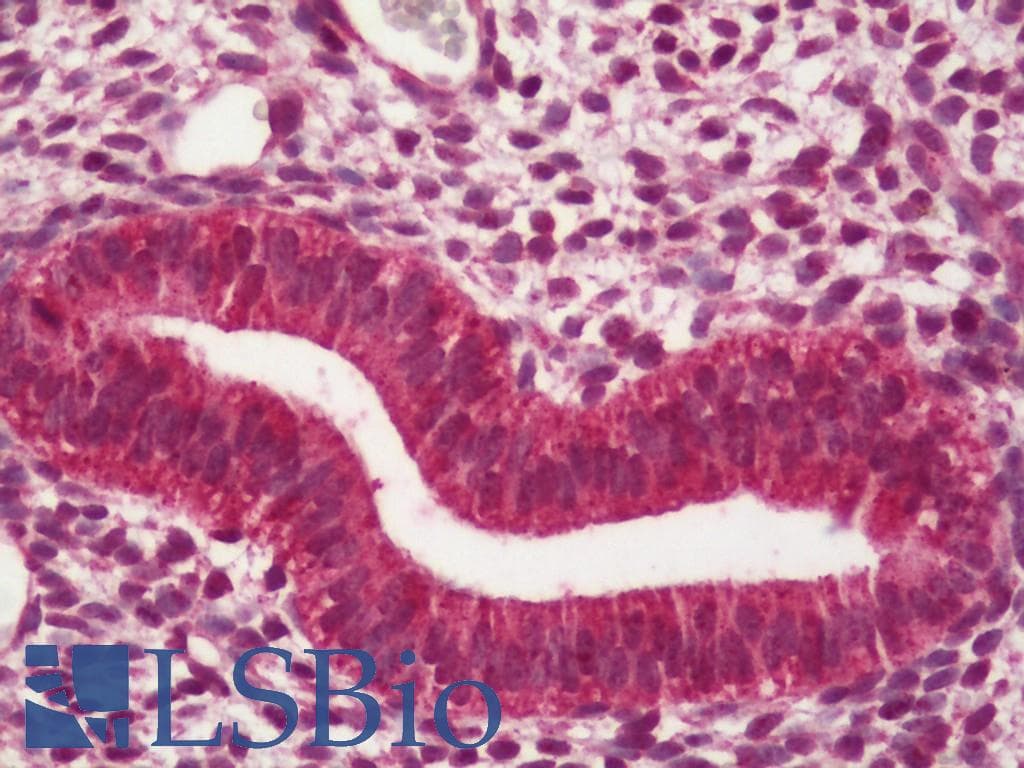IHC-plus™ ESR2 / ER Beta Antibody