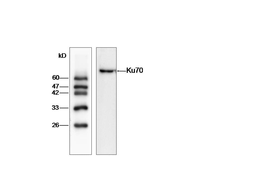 XRCC6 / Ku70 Antibody (aa29-461)