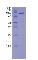 Rat NOG / Noggin Protein (Native His-MBP, N-terminus)