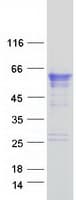 Human TMPRSS4 Protein (Recombinant Myc-DDK (Flag))
