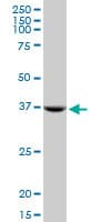 IHC-plus™ STX18 / Syntaxin 18 Antibody (clone 2E5)