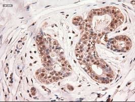 MYC / c-Myc Antibody (clone OTI5G3)