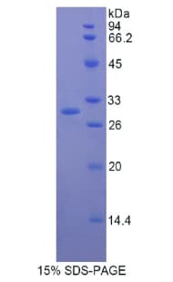 Human MMRN1 Protein (Recombinant His)