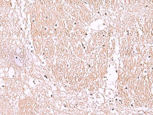 RIC8A Antibody