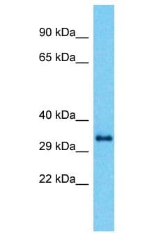 Polyclonal Rabbit anti-Human CCDC64B Antibody (aa91-140, WB)