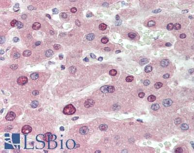 IHC-plus™ Polyclonal Rabbit anti-Human OPRS1 / SIGMAR1 Antibody (IHC, WB)
