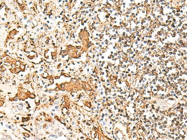 HLA-DRB1 Antibody