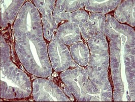 PAP2a / PPAP2A Antibody (clone OTI1H4)