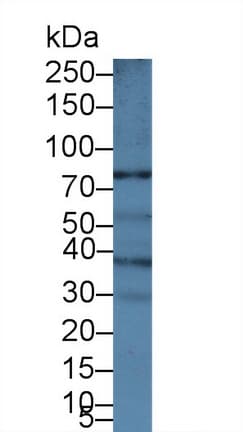 ABCB5 Antibody (aa570-808, APC)