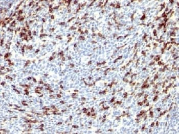 Polyclonal Rabbit anti-Human PDCD1 / CD279 / PD-1 Antibody (IHC, IF)