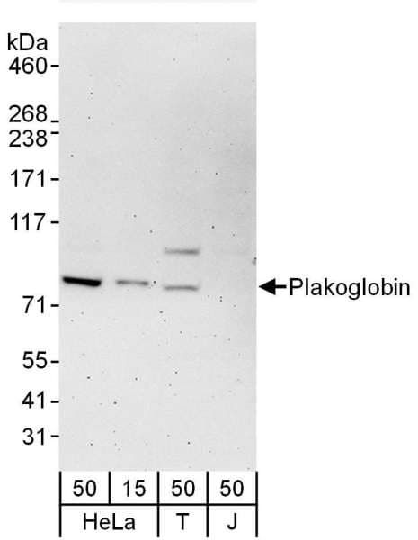 JUP/CTNNG/Junction Plakoglobin Antibody (aa1-50)