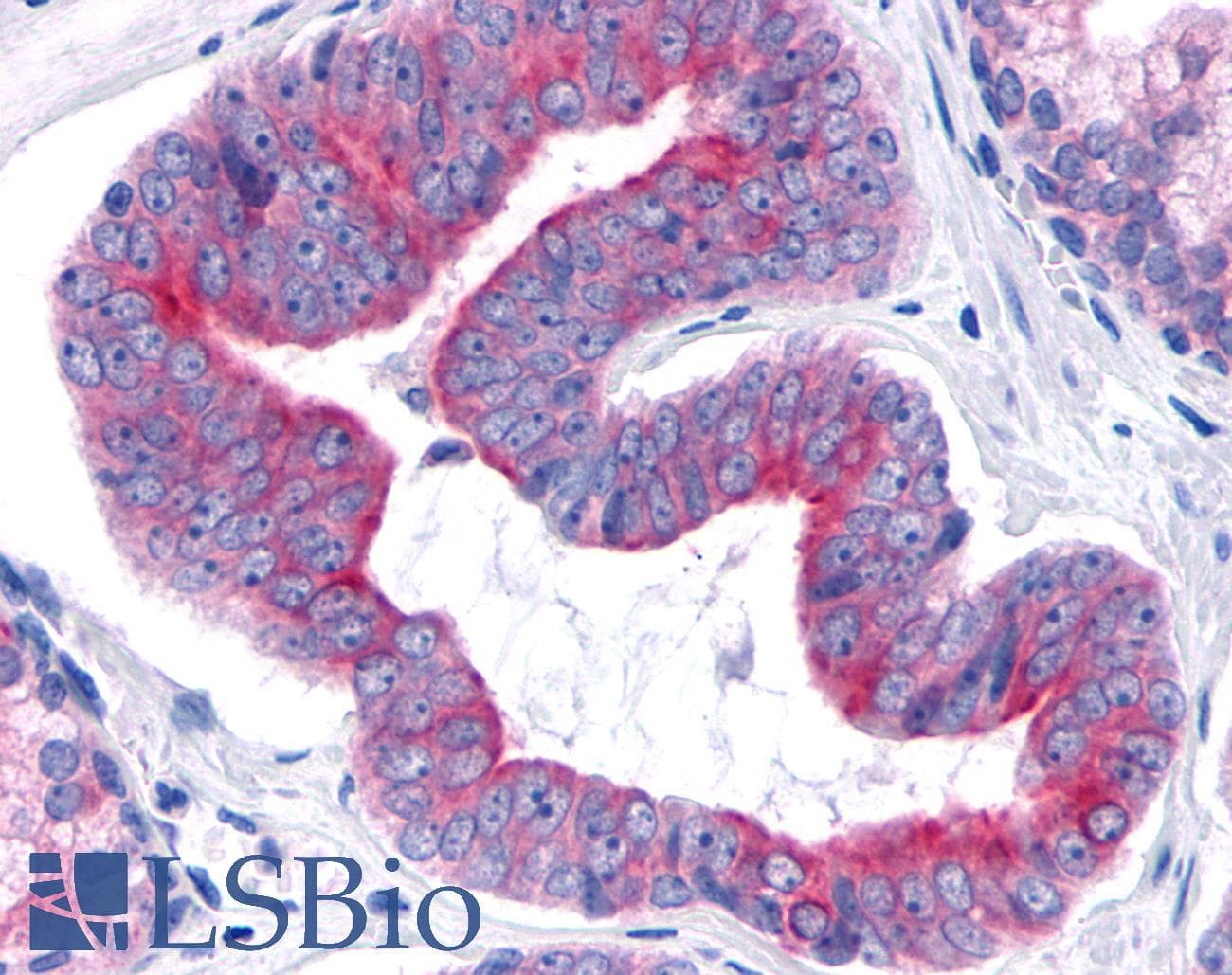 PathPlus™ TNIK Antibody (Internal)