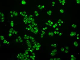 SATB1 Antibody (clone OTI10G2)