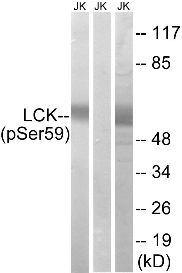 Polyclonal Rabbit anti-Human p56lck / LCK Antibody (phospho-Ser59, WB)
