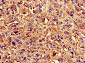 ARAP3 Antibody
