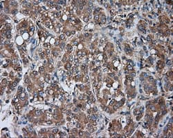 PRKAR2A Antibody (clone OTI1B4)