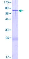 Human ARRDC2 Protein (Recombinant GST)