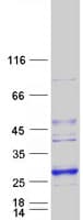 Human LYPLAL1 Protein (Recombinant Myc-DDK (Flag))